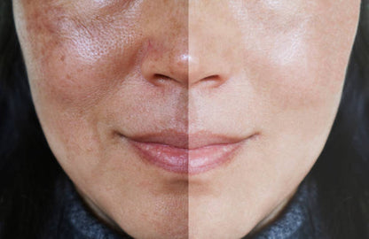 Serum Niacinamida the Ordinary ¡luce una piel más sana y linda!