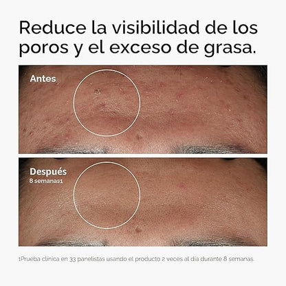 Serum Niacinamida the Ordinary ¡luce una piel más sana y linda!